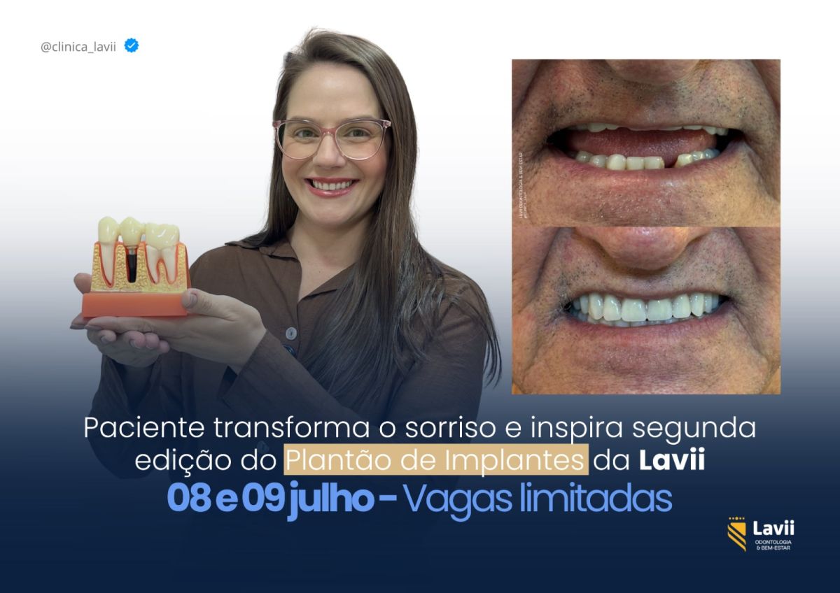 Faltam apenas 5 dias: paciente transforma o sorriso e inspira segunda edição do Plantão de Implantes da Lavii